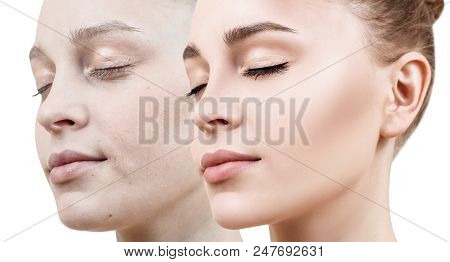Comparison Portrait Of Young Woman With And Without Makeup. Close-up Shot.