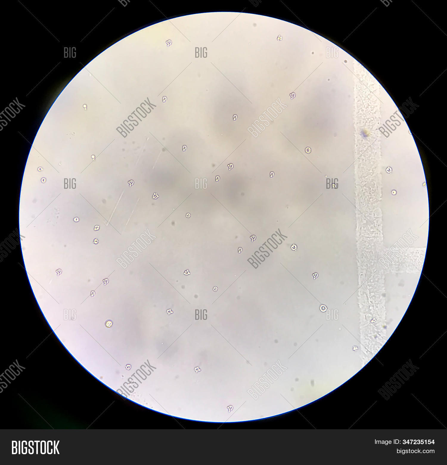 Moderate Dysmorphic Image & Photo (Free Trial) | Bigstock