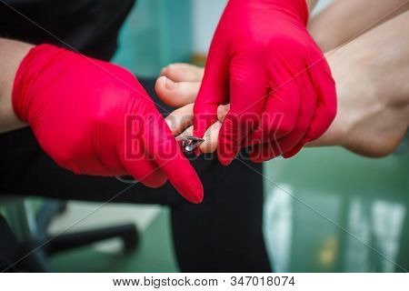 Podiatrist Treating Toenail Fungus. Podology Treatment. Close-up.