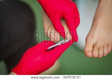 Podiatrist Treating Toenail Fungus. Podology Treatment. Close-up.
