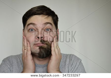 Bearded Man, Part Of The Face Without A Beard, Shaved. The Man Touches His Face With His Hands. Humo