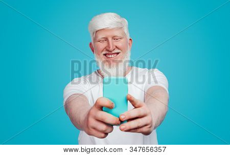 Cheerful Positive Adult Bearded Male With Albinism Wearing White T Shirt Standing Against Bright Blu