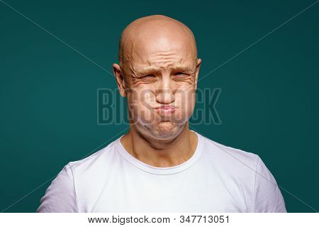 Portrait Of A Bald Man Puffed Out His Cheeks On A Blue Background