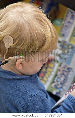 A Boy With A Hearing Aids And Cochlear Implants