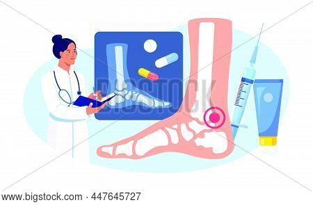 Ankle Foot Arthritis. Doctor Examining Xray Pictures Of Joints. Osteoarthritis, Rheumatoid Arthritis