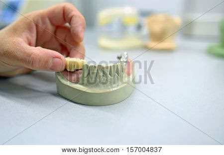 Dental technician working in dental laboratory