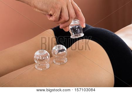 Close-up Of A Therapist Using Glass Cup For Cupping Therapy To Woman In Beauty Spa