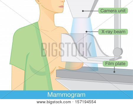 Woman get mammograms for breast cancer screening. Illustration about protection breast cancer with medical technology.