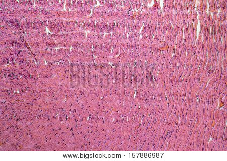 Heart Micrography