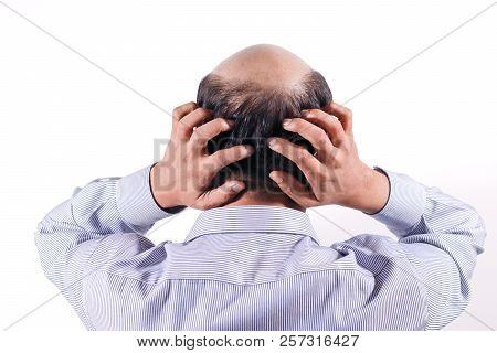 Bald Businessman With His Head On Scalp View From Behind With White Background