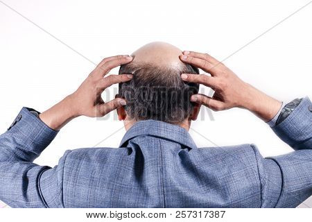 Bald Businessman With His Head On Scalp View From Behind With White Background