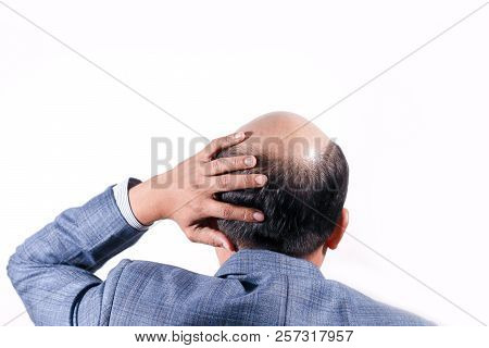 Bald Businessman With His Head On Scalp View From Behind With White Background