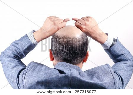Bald Businessman With His Head On Scalp View From Behind With White Background