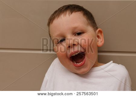 Boy, Child, In A White T-shirt Opened His Mouth On Examination With A Doctor. A Dentist Or An Otolar