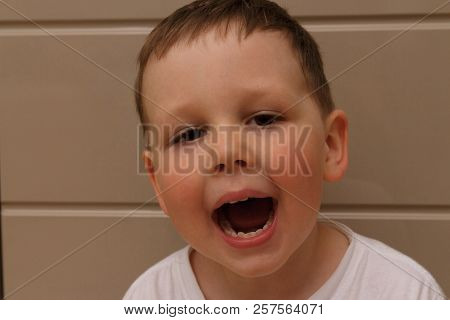 Boy, Child, In A White T-shirt Opened His Mouth On Examination With A Doctor. A Dentist Or An Otolar