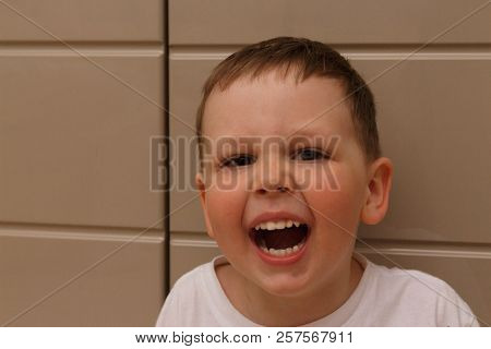 Boy, Child, In A White T-shirt Opened His Mouth On Examination With A Doctor. A Dentist Or An Otolar