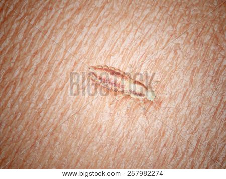3d rendered medically accurate illustration of a head louse on human skin