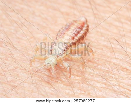 3d rendered medically accurate illustration of a head louse on human skin
