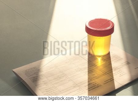 Urinalysis, Drug Testing, Drug. Plastic Jars For Medical Tests.. Urine Test