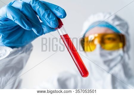 Closeup Of Microbiologist Or Medical Worker Hand With Blue Surgical Gloves Marking Blood Test Result