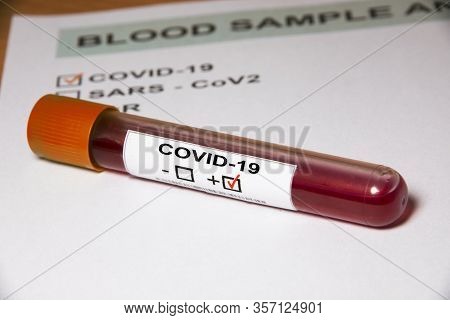 Result form and Blood sample test tube positive with COVID-19 or novel coronavirus