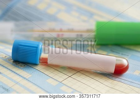 Blood Test Tube With Thermometer For Patient Examination. Blood In Test Tubes And Investigation Form