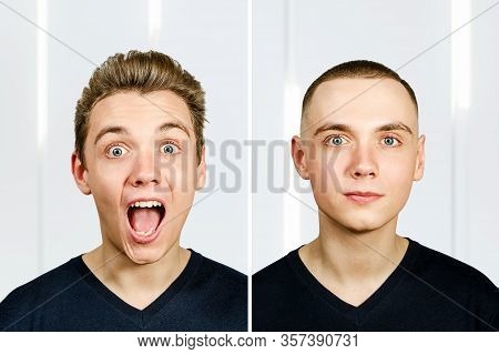Person Before Arter Haircut With Hair Loss: Bald And Pompadour, Transplant And Transformation