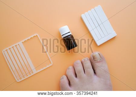 A Modern Method Of Treating Nail Fungus With Special Medical Varnish. Medications For Treating Toena
