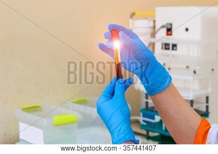 Blood Sample For Research In Microtube. Testing In Laboratory. Chemical Research. Prevention. Pneumo