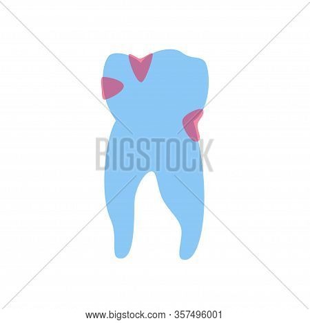 Vector Isolated Illustration Of Tooth With Caries. Types Of Teeth Decay Medical Poster. Banner For D