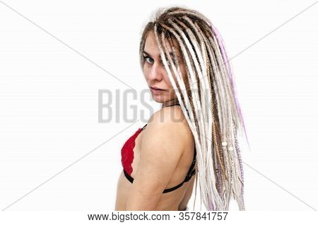 Girl With Bad Skin Acne And Black Red Festering Pimples  On The Face And Body