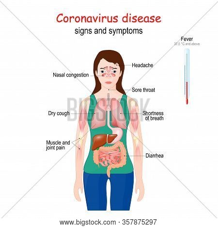 Coronavirus Disease. Covid-19. Signs And Symptoms Of This Infectious Disease. Flu-like Symptoms. Vec