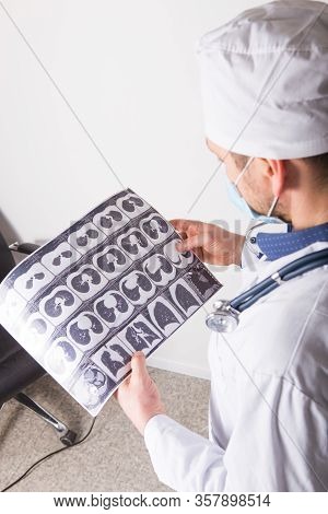 Doctor At Appointment Inspects And Examines Ct Scan Of Chest And Abdominal Cavity. Concept Photo On 