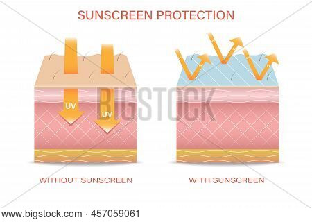 Protection Of The Skin From Ultraviolet Radiation. Damaged Human Skin Exfoliates Before And After Su