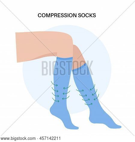 Compression Stocking Concept. Pressure Problems With Varicose Veins. Special Fitness Socks For Insuf