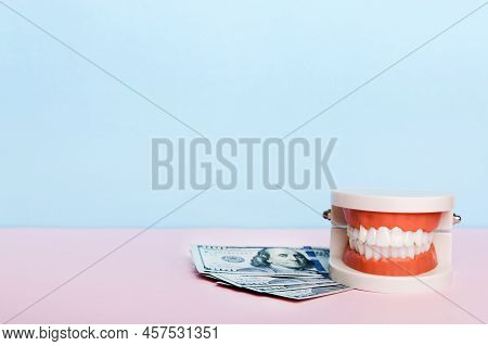 Closeup Model Of A Human Jaw With White Teeth And Dollar Bill. Dentistry Conceptual Photo. Prostheti