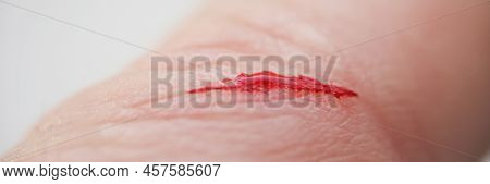Close-up Of Injured Person Finger With Bleeding Blood On Open Cut Wound. Cut Made With Sharp Knife. 