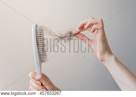 Female Hand Pulls Out A Clump Of Hair From A Comb. Close-up. The Concept Of Alopecia And Hair Loss.