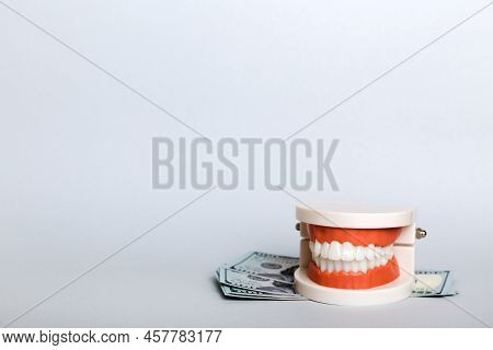 Closeup Model Of A Human Jaw With White Teeth And Dollar Bill. Dentistry Conceptual Photo. Prostheti