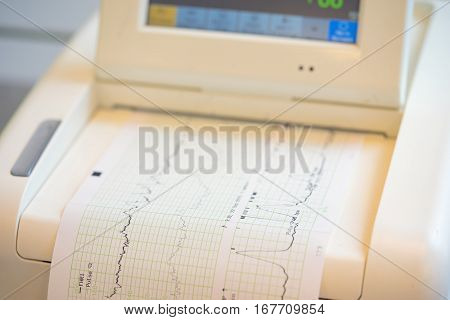 Printing Of Cardiogram Report Coming Out From Electrocardiograph In Labour Ward