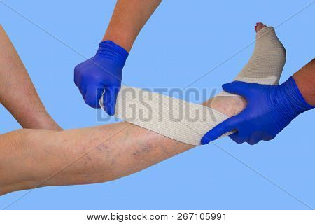Legs. Varicose Veins. Phlebeurysm. Thrombophlebitis Elastic Bandage At Studio