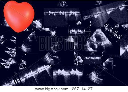 Cardiac Ultrasound Images And Small Heart . Screen Of Echo-cardiography Machine. Doppler Echo