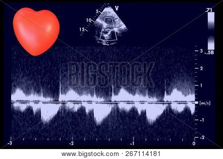 Cardiac Ultrasound Images And Small Heart . Screen Of Echo-cardiography Machine. Doppler Echo