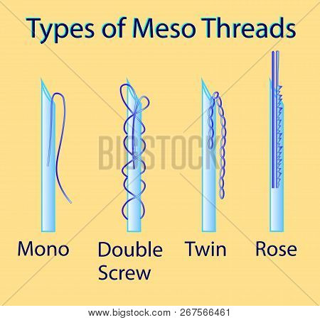 Vector Illustration With Types Of Meso Threads