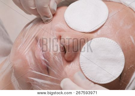 Close-up. Eastern Woman Lies On The Procedure Of Skin Rejuvenation In The Beauty Salon Of A Medical 