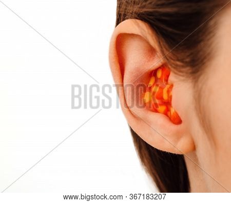 Earplugs For Noisy Places, Personally Molded Earplugs On Ear Close-up, Isolated On White