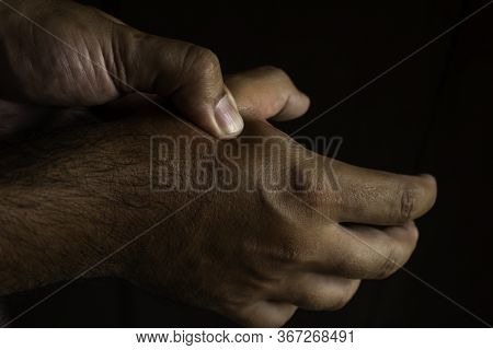 Adult Male Hands With Abundant Hair Pressing The Metacarpus. Hand Massages