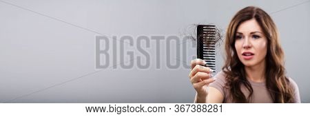 Hairfall And Hairloss. Worried Woman With Hair Loss