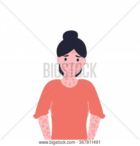 Red Rash Vector Images Red Rash All Over Vector & Photo (Free Trial) | Bigstock