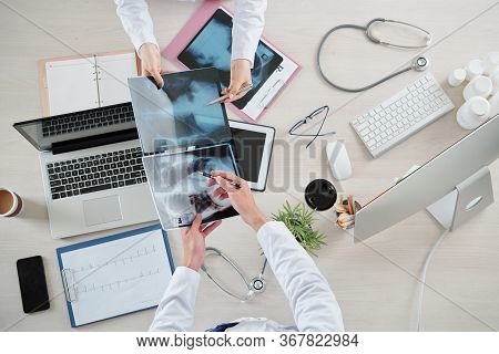 Pulmonologists Comparing Chest X-rays Of Sick And Recovered Patients